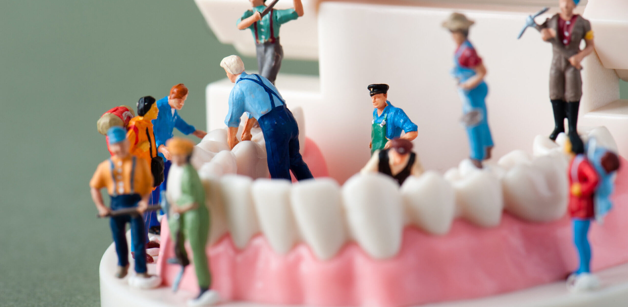 国内での歯科インプラント トラブル急増の理由