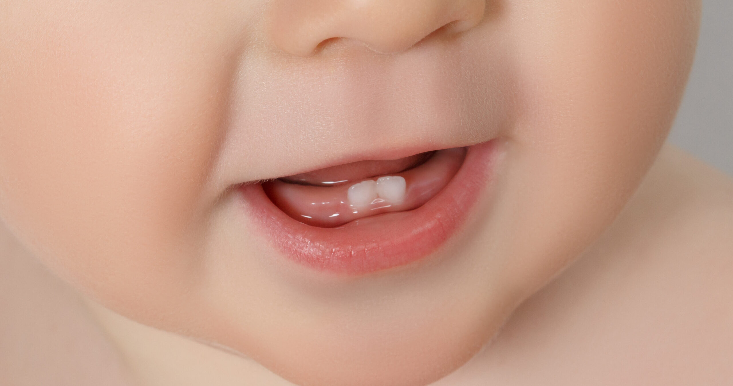 乳幼児の虫歯について
