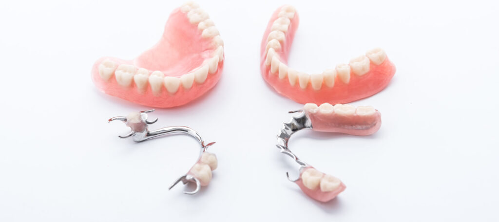 入れ歯の治療のQ＆A