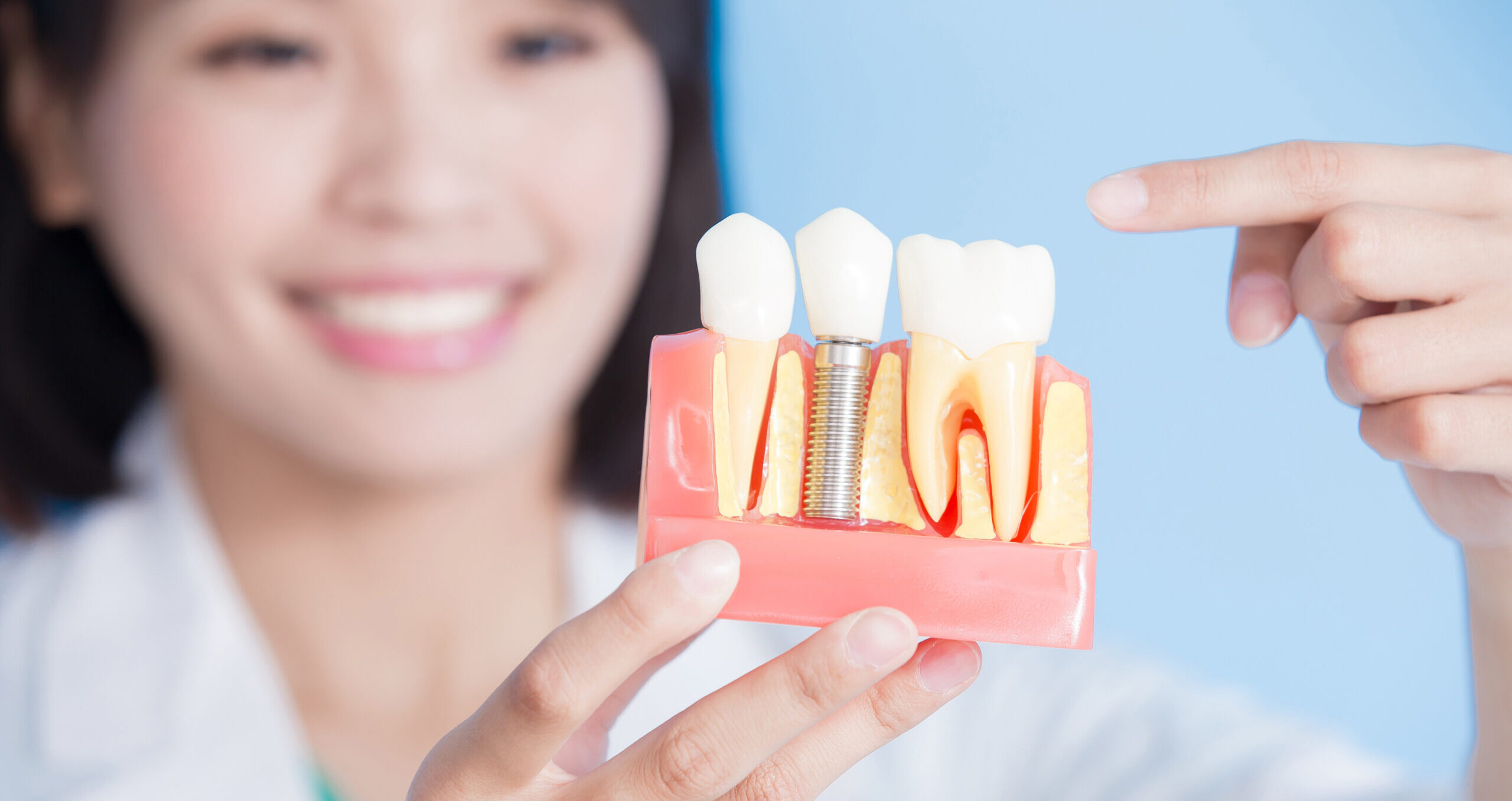 歯科インプラント治療は保険が適用されないのはなぜ？