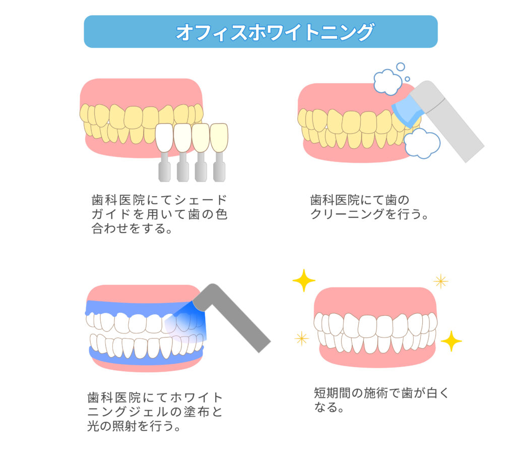 オフィスホワイトニング　歯のホワイトニング　歯医者　西田辺えがしら歯科