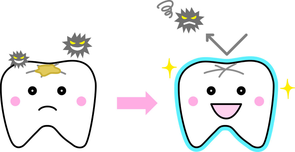 阿倍野区　歯医者　西田辺えがしら歯科　虫歯予防とフッ素の役割とリスク