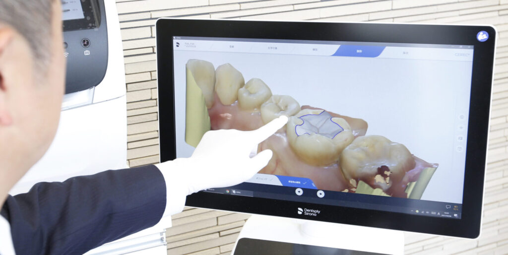 デジタルデンティストリー　口腔内スキャナー　CAD/CAM　3Dプリンター　デジタル治療　阿倍野区　歯医者　西田辺えがしら歯科