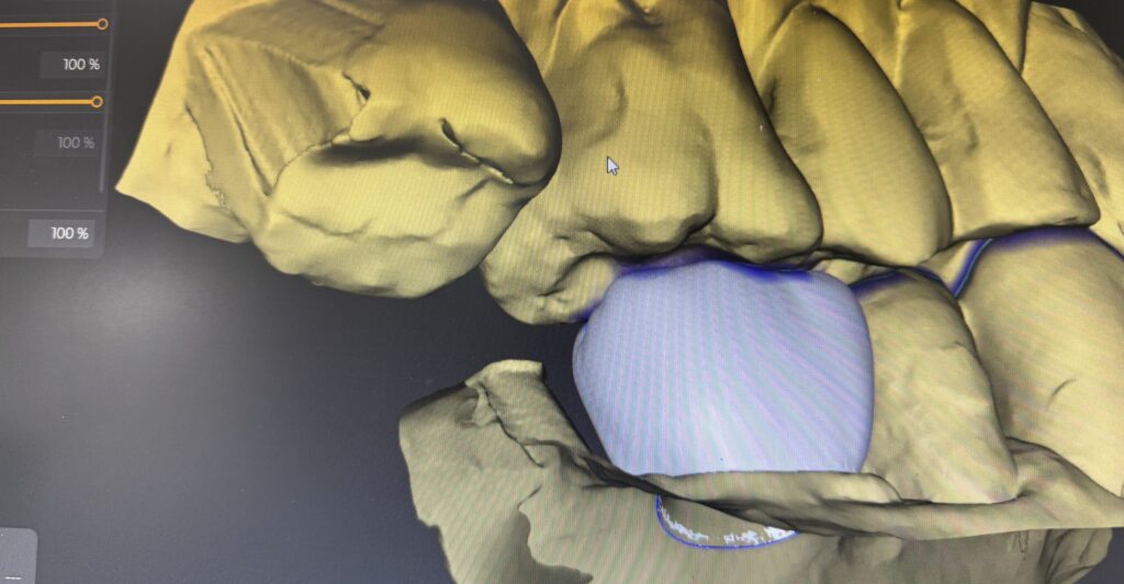 大阪口腔インプラント研究会　歯医者　西田辺えがしら歯科　