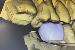 大阪口腔インプラント研究会　歯医者　西田辺えがしら歯科　