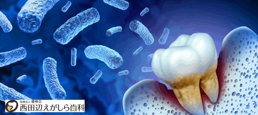 歯周病 大腸がん 関係 細菌 西田辺えがしら歯科 歯医者