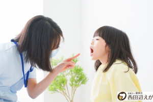 口腔機能発達不全症 口ぽかん 子供　食べ方　治療　歯医者