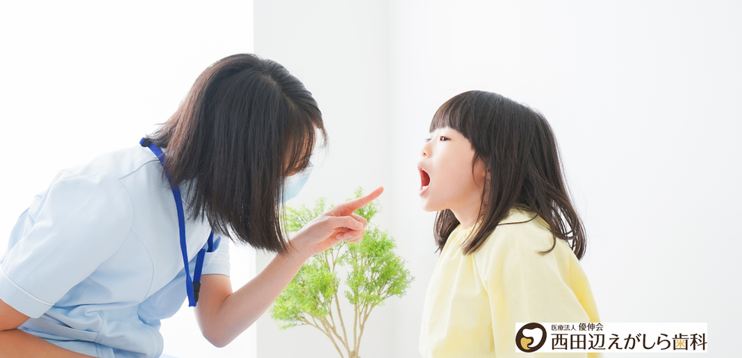 口腔機能発達不全症とは？子どもの口ぽかんや食べ方を阿倍野区・西田辺の歯医者が解説