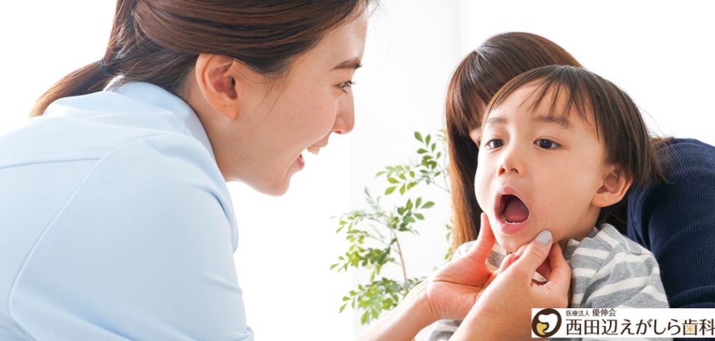 口腔機能発達不全症 口ぽかん 子供 食べ方 治療 歯医者