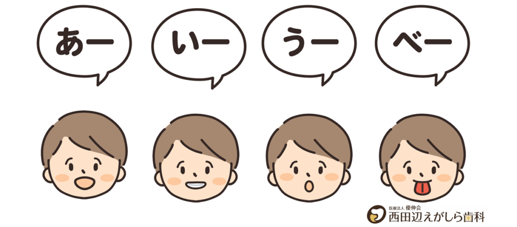 口腔機能発達不全症 口ぽかん 子供 食べ方 治療 歯医者