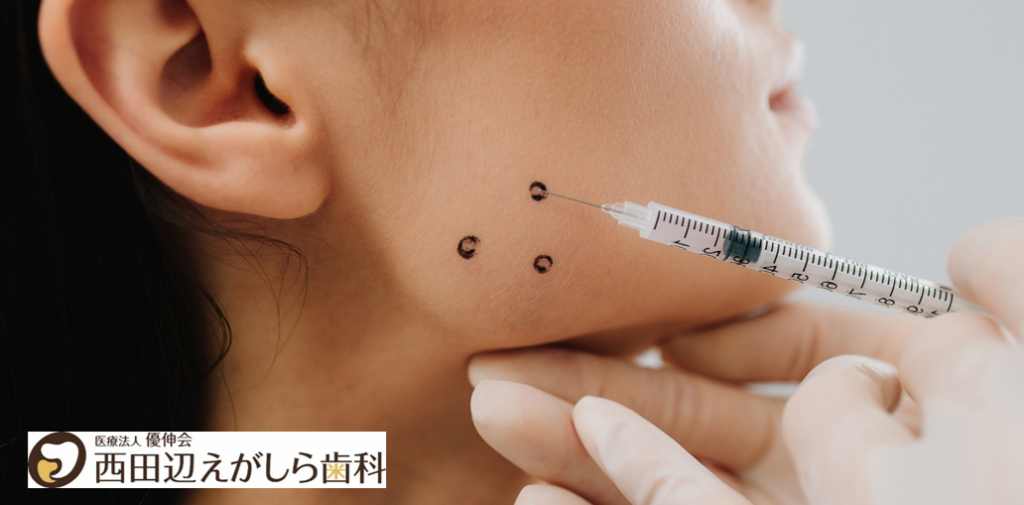 食いしばり　歯ぎしり　西田辺えがしら歯科　ナイトガード　ボトックス
