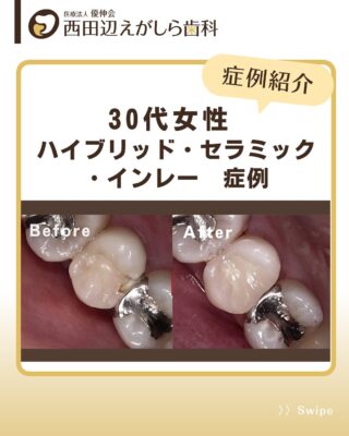 抜歯後の痛みと偶発症 Amazon.co.jp: しっかり学ぶ抜歯後の痛みと偶発症 : 管野貴浩: 本