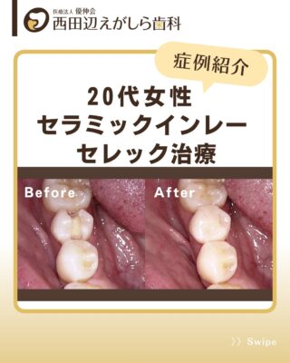 【裁断済み】抜歯後の痛みと偶発症 しっかり学ぶ抜歯後の痛みと偶発症 口腔外科に強くなる